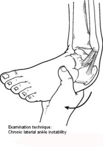 Ankle Pain Diagnosis in San Mateo, CA at Peninsula Foot & Ankle Center